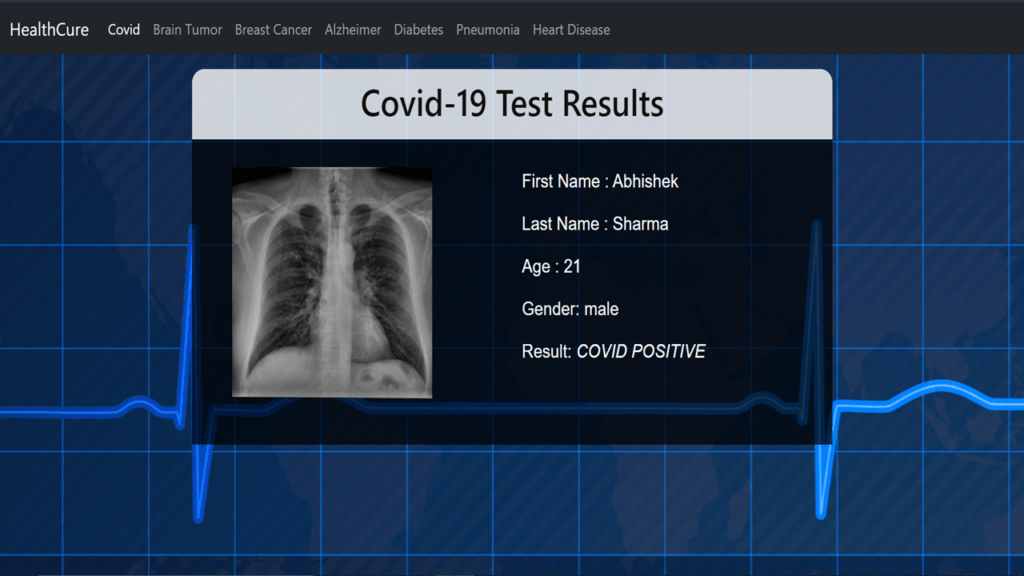 Covid-19 detection Machine learning projects with source code in Python - flask projects with source code in python
