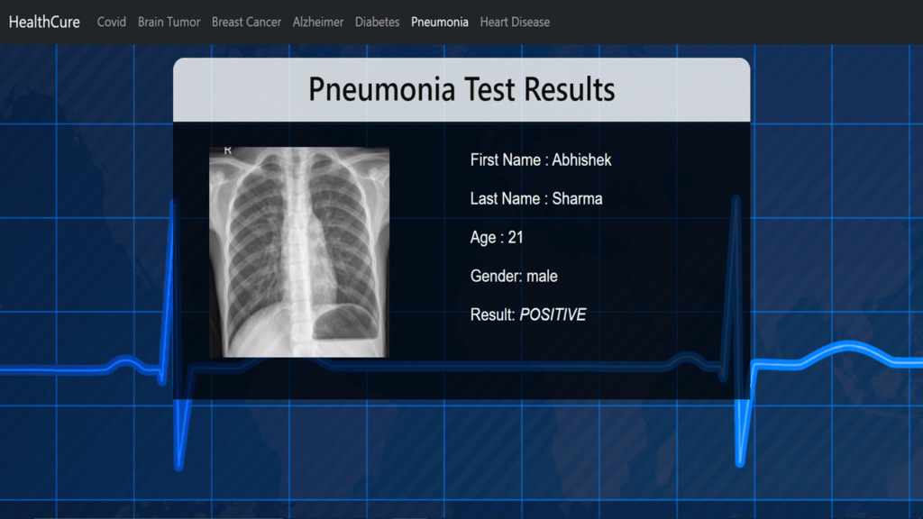 Pneumonia detection Final Year Python Projects