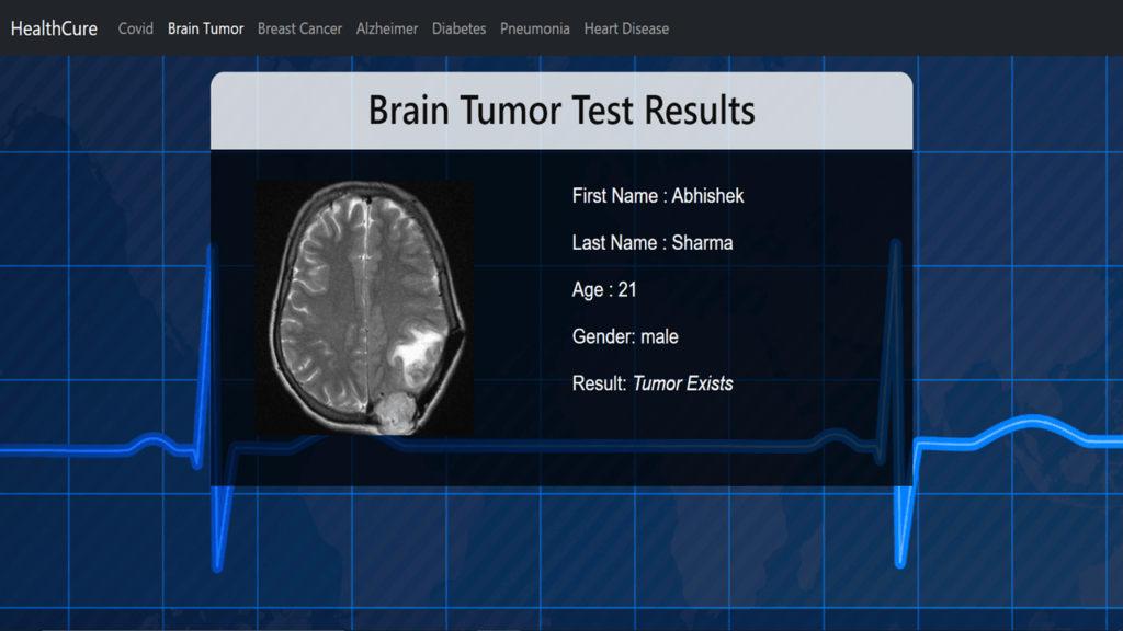 Brain Tumour detection