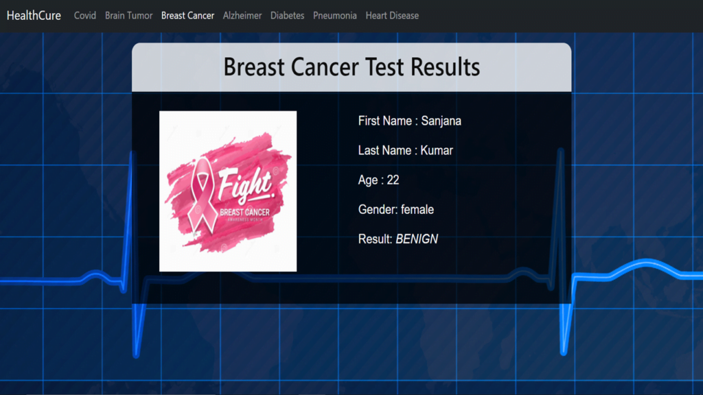 Breast Cancer detection Final Year Python Projects